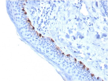 TRP1 / Tyrosinase-Related Protein-1 Antibody