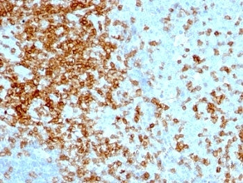 CD43 Antibody