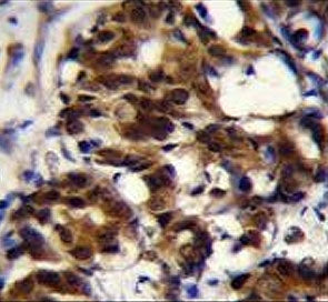 TNFR1-associated DEATH domain protein Antibody / TRADD
