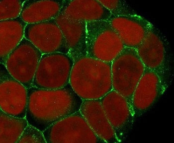 E-Cadherin Antibody / CDH1