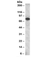 SETMAR Antibody