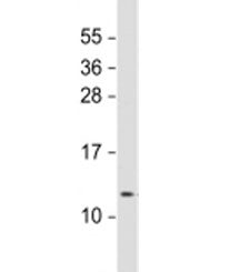 RIG Antibody / Protein regulated in glioma