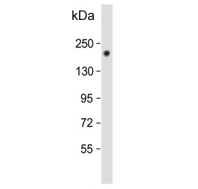 HER2 Antibody / ErbB2 / C-terminal region