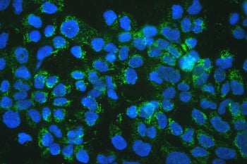 TFAM Antibody / mtTFA