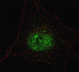 PDX1 Antibody (phospho-T11)