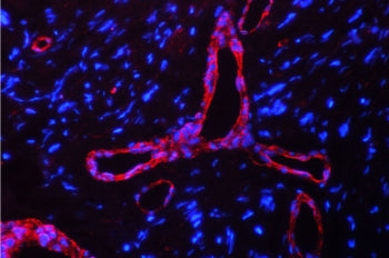 Immunofluorescent staining of FFPE human glioma tissue with Calveolin-1 antibody (red) and DAPI nucl