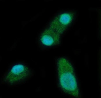 Immunofluorescent staining of FFPE human SiHa cells with YTH domain-containing protein 2 antibody (g