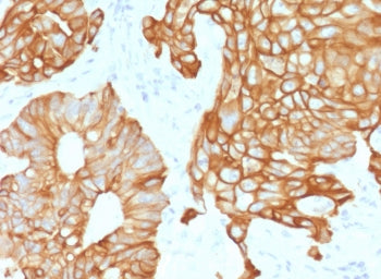 KRT19 Antibody / Cytokeratin 19