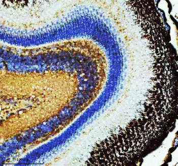 IHC staining of FFPE zebrafish retina tissue with Ppp2ca antibody, HRP secondary and DAB substrate.