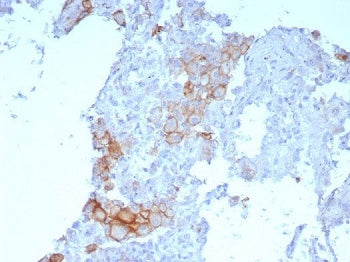 PD-L1 Antibody / B7-H1 / CD274