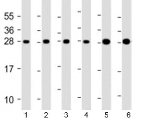 RPL14 Antibody / Ribosomal Protein L14