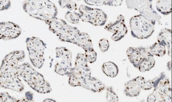 Apoptosis inhibitor 5 Antibody
