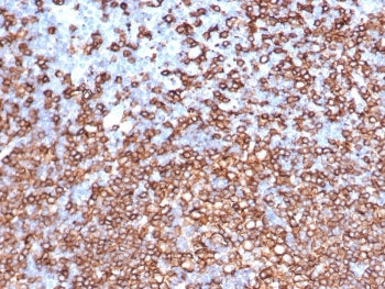IHC staining of FFPE human lymph node with recombinant CD20 antibody (clone IGEL/6850R). HIER: boil