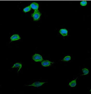 PTCH2 Antibody / Patched 2
