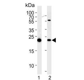 Interleukin-1 Receptor Antagonist Antibody / IL1RA / IL1RN