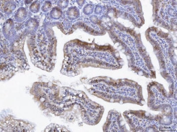 IHC staining of FFPE mouse lymph tissue with TOX antibody. HIER: boil tissue sections in pH8 EDTA fo