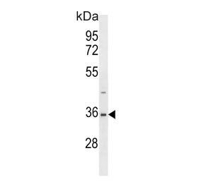 SAE1 Antibody