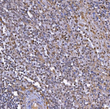 IHC staining of FFPE human spleen tissue with TOP3B antibody. HIER: boil tissue sections in pH8 EDTA