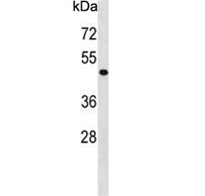 PHKG2 Antibody