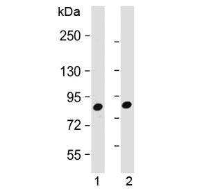 MUT Antibody / Methylmalonyl-CoA mutase
