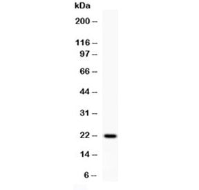 Rat Interferon gamma Antibody