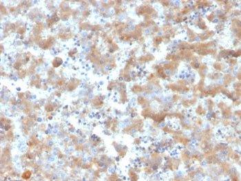 IHC staining of FFPE human liver tissue with Alpha-2-Macroglobulin antibody (clone A2M/6555). HIER: