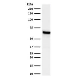 Estrogen Receptor alpha Antibody