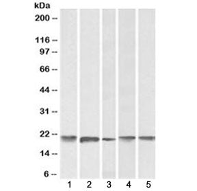FTL Antibody