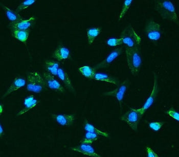 Angiopoietin 2 Antibody / ANG2