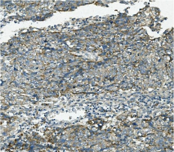 VPS4B Antibody / MIG1