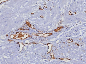 IHC staining of FFPE human uterus tissue with CD31 antibody (clone C31/8377R). HIER: boil tissue sec
