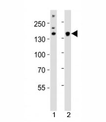 Western blot analysis of lysate from 1) HeLa cell line and 2) mouse cerebellum tissue using Kdm6b an