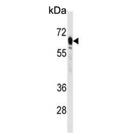 PCK2 Antibody / PEPCK2