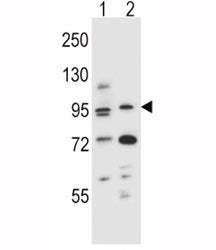 Aryl Hydrocarbon Receptor Antibody (AHR)