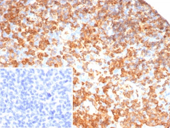 SHP-1 Antibody / PTPN6
