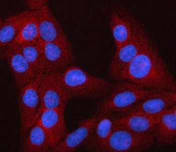 LEKR1 Antibody / Leucine-, glutamate- and lysine-rich protein 1
