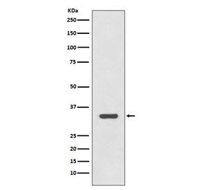 HLA-DR Antibody (MHC II)