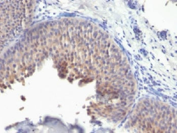 KRT10 Antibody / Cytokeratin 10