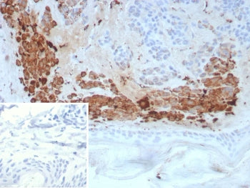 IHC staining of FFPE human skin tissue with KLK4 antibody (clone KLK4/8941). HIER: boil tissue secti