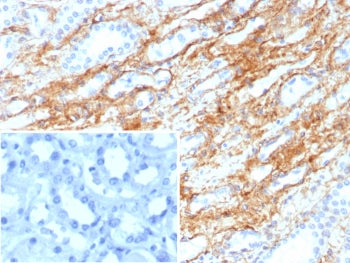 Collagen IV Antibody