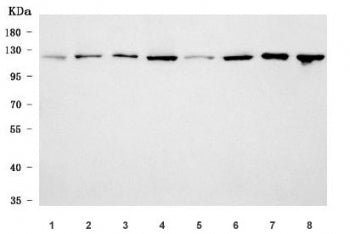 SF3a120 Antibody / Splicing factor 3A subunit 1 / SF3A1