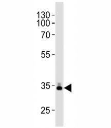 ApoE Antibody (Apolipoprotein E)