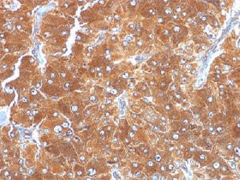 IHC testing of FFPE human adrenal tissue with ADRP antibody (clone ADFP/1494). Required HIER: steam