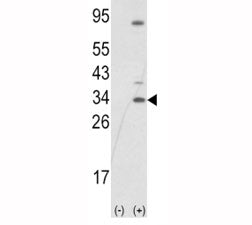 SNAI1 Antibody