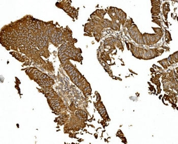 BDH1 Antibody