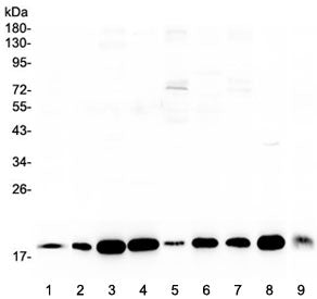LIF Antibody / Leukemia inhibitory factor / CDF
