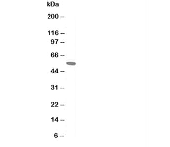 AChR Antibody (nicotinic)