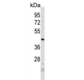PRB2 Antibody / Basic salivary proline-rich protein 2
