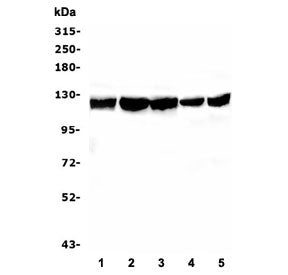 BUB1B Antibody / BubR1