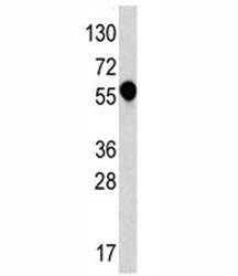 IL-1 Receptor type 1 Antibody
